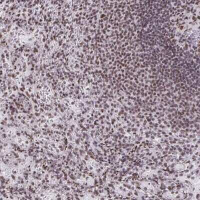 Immunohistochemistry-Paraffin: SNRP70 Antibody [NBP2-37905]