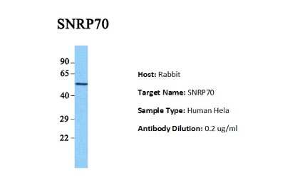 Western Blot: SNRP70 Antibody [NBP1-57455]