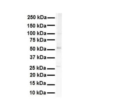 Western Blot: SNRP70 Antibody [NBP1-57487]