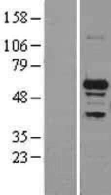 Western Blot: SNRP70 Overexpression Lysate [NBL1-16284]