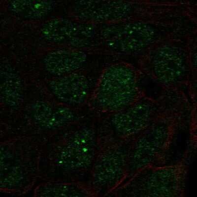 Immunocytochemistry/ Immunofluorescence: SNRPA1 Antibody [NBP2-33528]