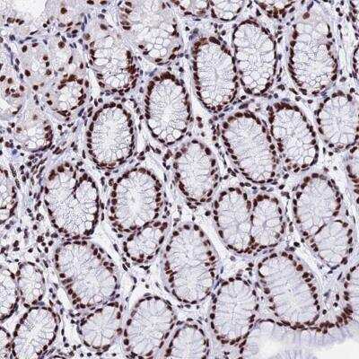 Immunohistochemistry-Paraffin: SNRPA1 Antibody [NBP2-33447]