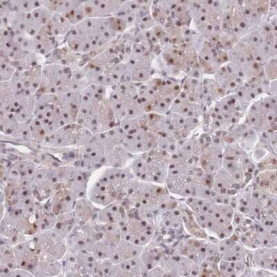 Immunohistochemistry-Paraffin: SNRPA1 Antibody [NBP2-33528]
