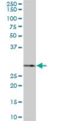 Western Blot: SNRPA1 Antibody [H00006627-B01P]