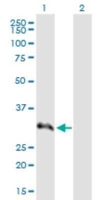 Western Blot: SNRPA1 Antibody [H00006627-B01P]