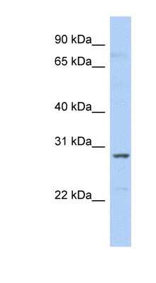 Western Blot: SNRPA1 Antibody [NBP1-57240]