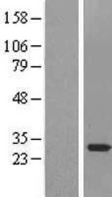 Western Blot: SNRPA1 Overexpression Lysate [NBL1-16286]