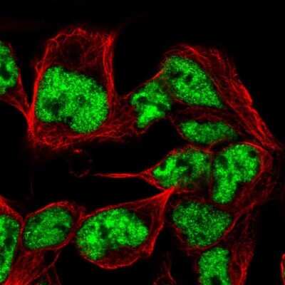 Immunocytochemistry/ Immunofluorescence: SNRPB Antibody [NBP2-56420]