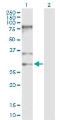 Western Blot: SNRPB Antibody [H00006628-D01P]