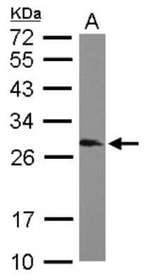 Western Blot: SNRPB Antibody [NBP1-32174]