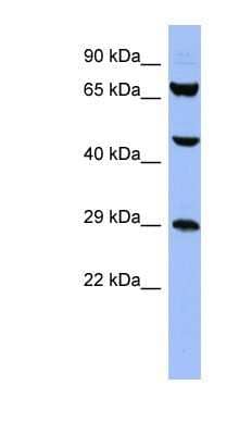 Western Blot: SNRPB Antibody [NBP1-57215]