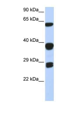 Western Blot: SNRPB Antibody [NBP1-57237]