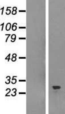 Western Blot: SNRPB Overexpression Lysate [NBL1-16287]