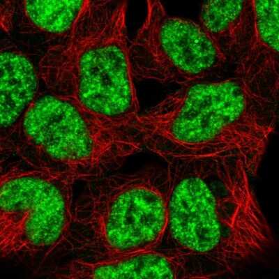 Immunocytochemistry/ Immunofluorescence: SNRPB2 Antibody [NBP2-58608]