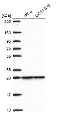 Western Blot: SNRPB2 Antibody [NBP2-69013]