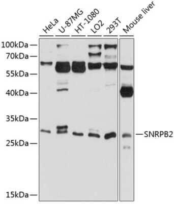 Western Blot: SNRPB2 AntibodyBSA Free [NBP2-93016]