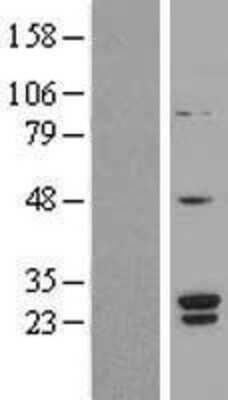 Western Blot: SNRPB2 Overexpression Lysate [NBL1-16289]