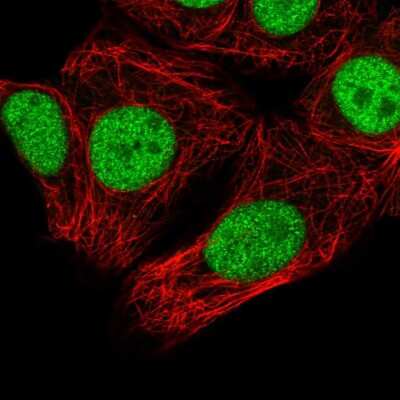 Immunocytochemistry/ Immunofluorescence: SNRPC Antibody [NBP2-59011]