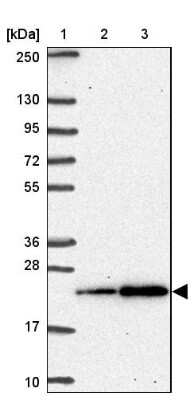 Western Blot: SNRPC Antibody [NBP2-38755]