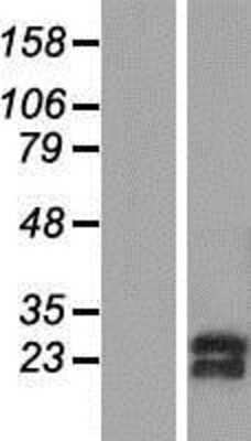 Western Blot: SNRPC Overexpression Lysate [NBP2-08039]