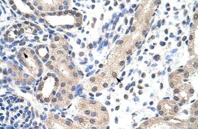 Immunohistochemistry-Paraffin: SNRPD1 Antibody [NBP2-83569]