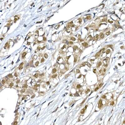 Immunohistochemistry-Paraffin: SNRPD1 Antibody - Azide and BSA Free [NBP2-94494]