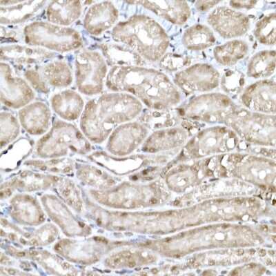 Immunohistochemistry-Paraffin: SNRPD1 Antibody - Azide and BSA Free [NBP2-94494]