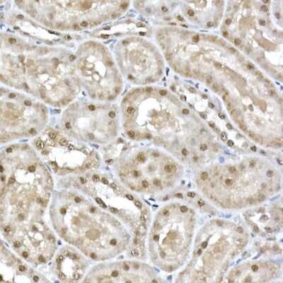 Immunohistochemistry-Paraffin: SNRPD1 Antibody - Azide and BSA Free [NBP2-94494]