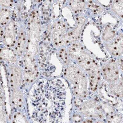 Immunohistochemistry-Paraffin: SNRPD1 Antibody [NBP2-36427]