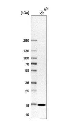 Western Blot: SNRPD1 Antibody [NBP2-36427]