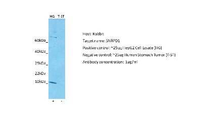 Western Blot: SNRPD1 Antibody [NBP2-83569]
