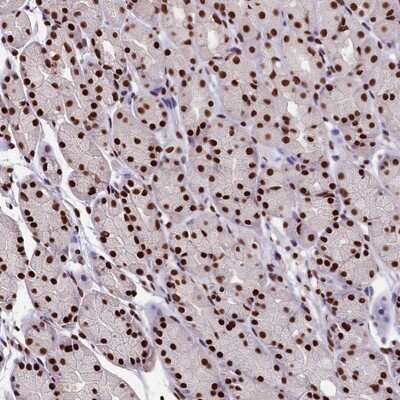 Immunohistochemistry-Paraffin: SNRPD2 Antibody [NBP1-87028]
