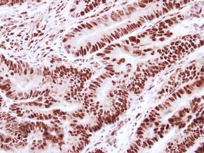 Immunohistochemistry-Paraffin: SNRPD2 Antibody [NBP2-20438]