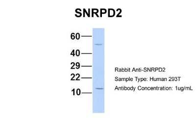 Western Blot: SNRPD2 Antibody [NBP1-57173]