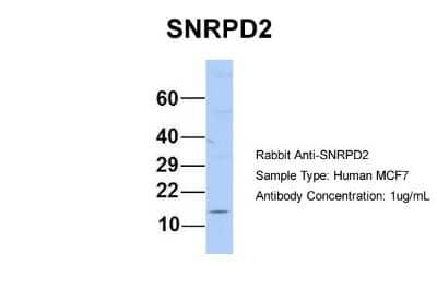 Western Blot: SNRPD2 Antibody [NBP1-57173]