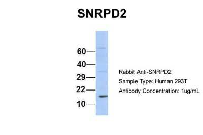 Western Blot: SNRPD2 Antibody [NBP1-57174]