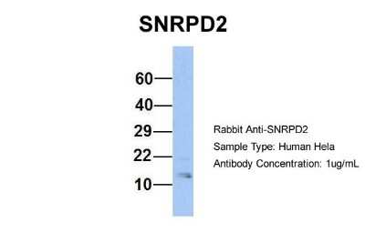 Western Blot: SNRPD2 Antibody [NBP1-57174]
