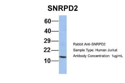 Western Blot: SNRPD2 Antibody [NBP1-57174]