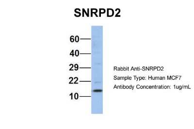 Western Blot: SNRPD2 Antibody [NBP1-57174]