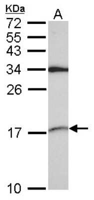 Western Blot: SNRPD2 Antibody [NBP2-20438]