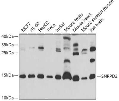 Western Blot: SNRPD2 AntibodyBSA Free [NBP2-93997]