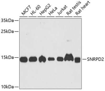 Western Blot: SNRPD2 AntibodyBSA Free [NBP2-95236]