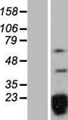 Western Blot: SNRPD2 Overexpression Lysate [NBP2-09805]