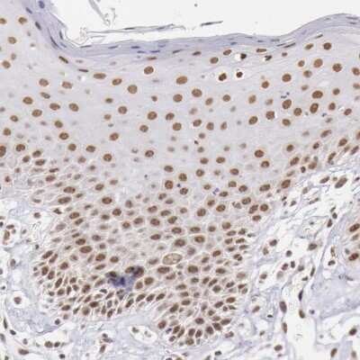 Immunohistochemistry-Paraffin: SNRPD3 Antibody [NBP1-80735]