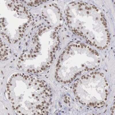 Immunohistochemistry-Paraffin: SNRPD3 Antibody [NBP1-80735]