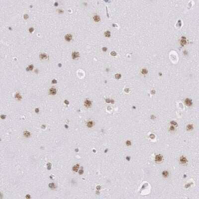 Immunohistochemistry-Paraffin: SNRPD3 Antibody [NBP1-80735]