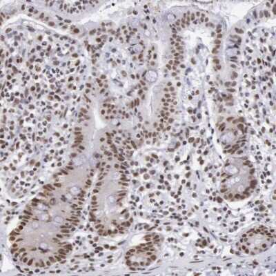 Immunohistochemistry-Paraffin: SNRPD3 Antibody [NBP1-80735]