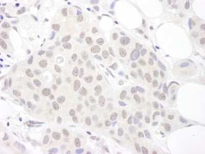 Immunohistochemistry-Paraffin: SNRPD3 Antibody [NBP2-22305]