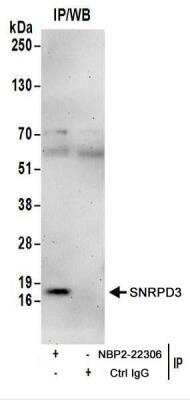 Immunoprecipitation: SNRPD3 Antibody [NBP2-22306]