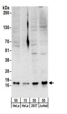 Western Blot: SNRPD3 Antibody [NBP2-22305]